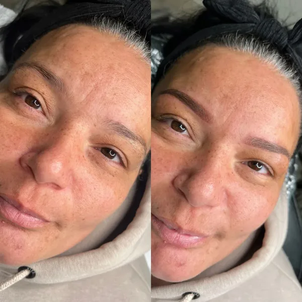 Uneven brows evened out with powder brows, before and after