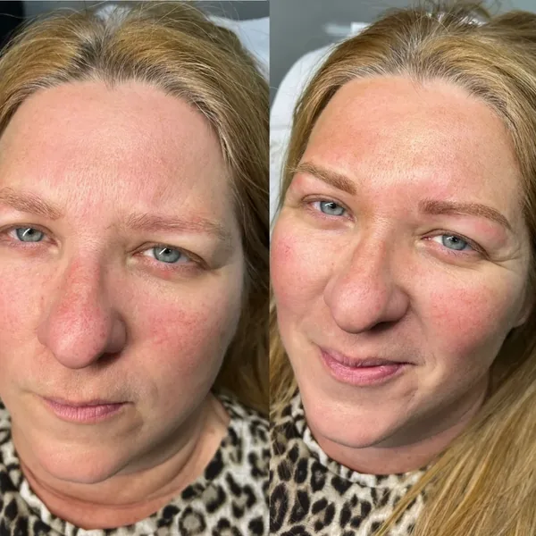 Fair sparse brows given definition with powder brows, before and after